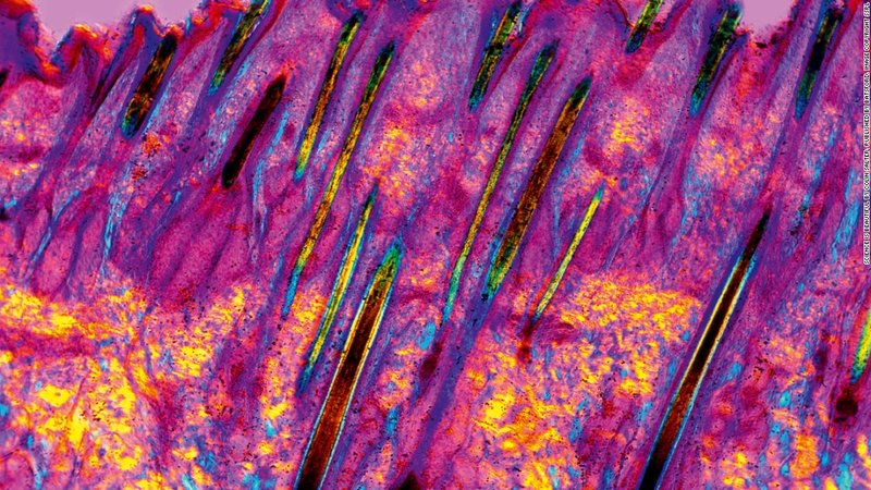 Кожа человека.jpg